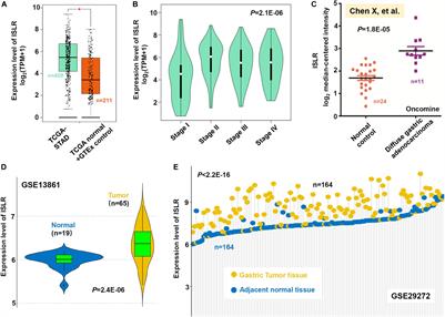 An Analysis Regarding the Association Between the ISLR Gene and Gastric Carcinogenesis